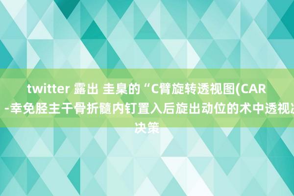 twitter 露出 圭臬的“C臂旋转透视图(CARV)”-幸免胫主干骨折髓内钉置入后旋出动位的术中透视决策